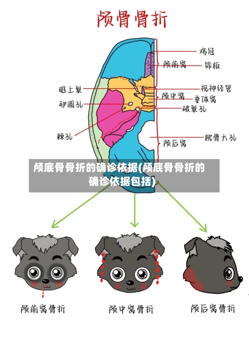 颅底骨骨折的确诊依据(颅底骨骨折的确诊依据包括)-第2张图片