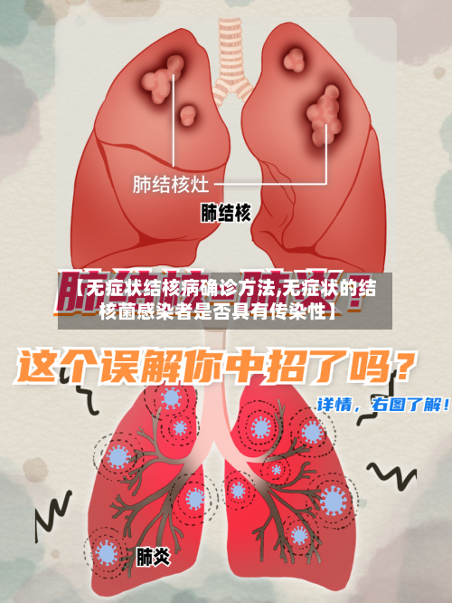 【无症状结核病确诊方法,无症状的结核菌感染者是否具有传染性】-第2张图片