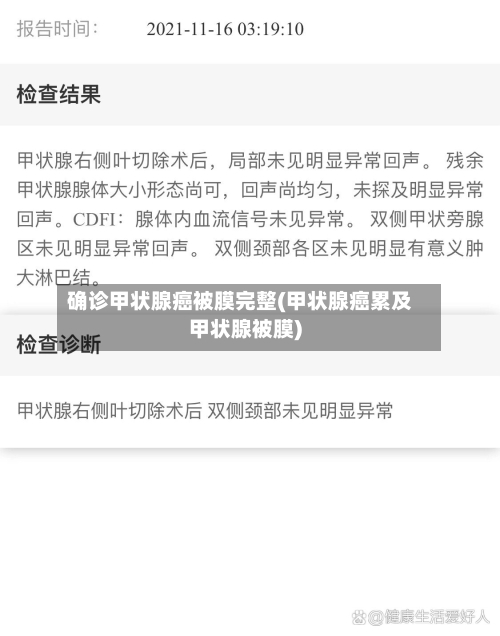 确诊甲状腺癌被膜完整(甲状腺癌累及甲状腺被膜)-第2张图片
