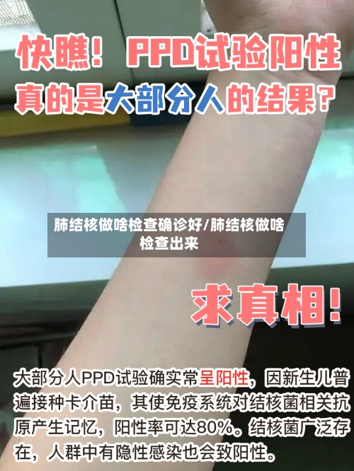 肺结核做啥检查确诊好/肺结核做啥检查出来-第3张图片