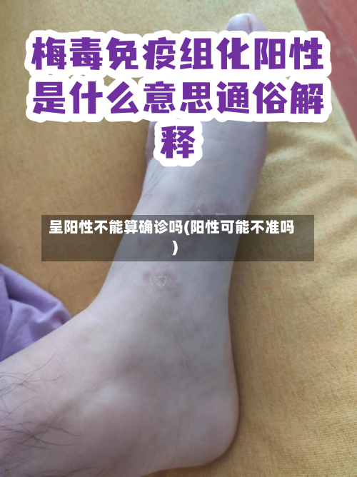 呈阳性不能算确诊吗(阳性可能不准吗)