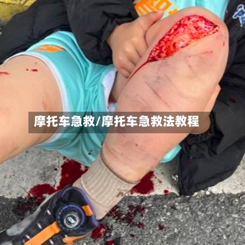 摩托车急救/摩托车急救法教程-第2张图片