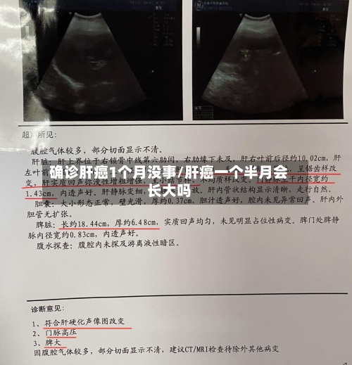 确诊肝癌1个月没事/肝癌一个半月会长大吗