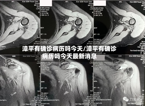 漳平有确诊病历吗今天/漳平有确诊病历吗今天最新消息-第2张图片