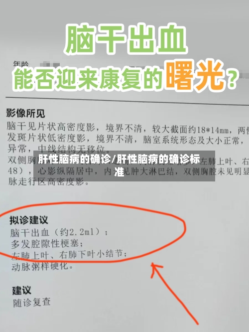 肝性脑病的确诊/肝性脑病的确诊标准