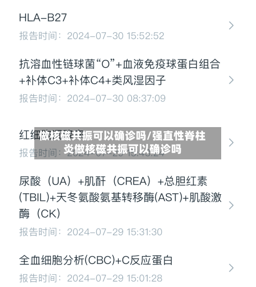 做核磁共振可以确诊吗/强直性脊柱炎做核磁共振可以确诊吗