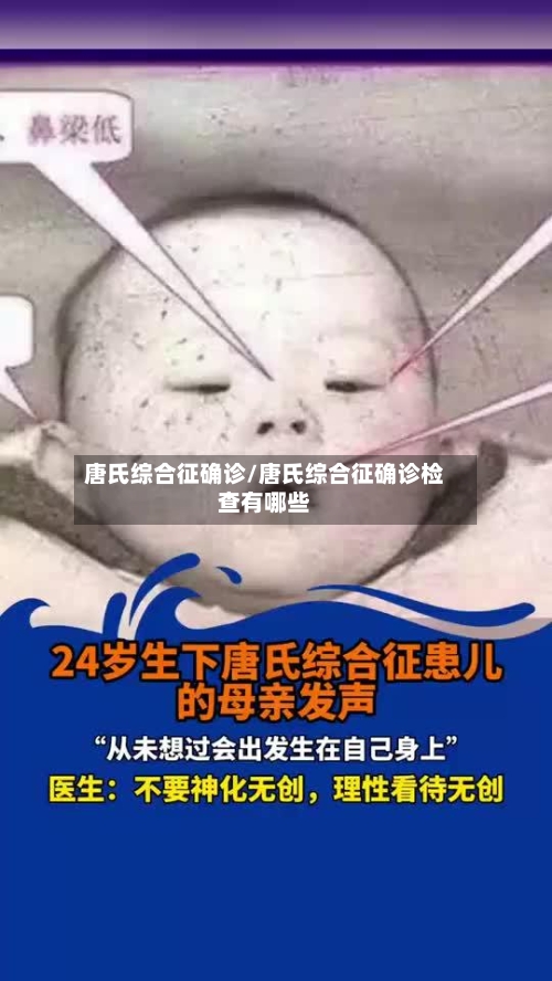 唐氏综合征确诊/唐氏综合征确诊检查有哪些-第2张图片
