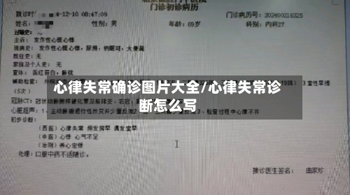 心律失常确诊图片大全/心律失常诊断怎么写-第3张图片