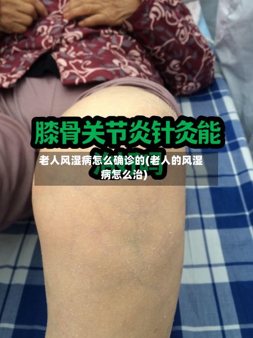 老人风湿病怎么确诊的(老人的风湿病怎么治)