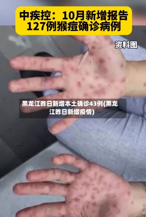 黑龙江昨日新增本土确诊43例(黑龙江昨日新增疫情)