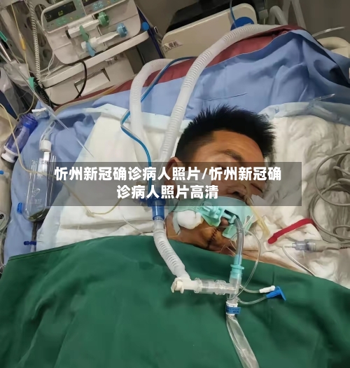 忻州新冠确诊病人照片/忻州新冠确诊病人照片高清