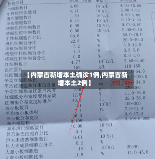 【内蒙古新增本土确诊1例,内蒙古新增本土2例】-第2张图片