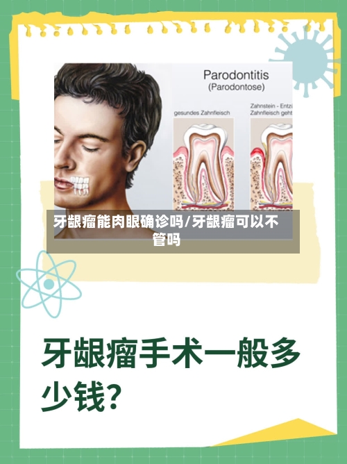 牙龈瘤能肉眼确诊吗/牙龈瘤可以不管吗-第3张图片