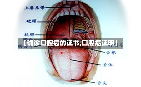 【确诊口腔癌的证书,口腔癌证明】