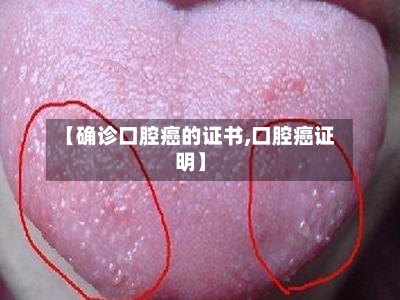 【确诊口腔癌的证书,口腔癌证明】-第3张图片